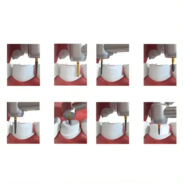 Coltene Crown Preparation Kit IN60013857 - Image 2